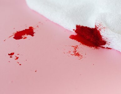 Plamy z krwi – skuteczne sposoby na ich usunięcie